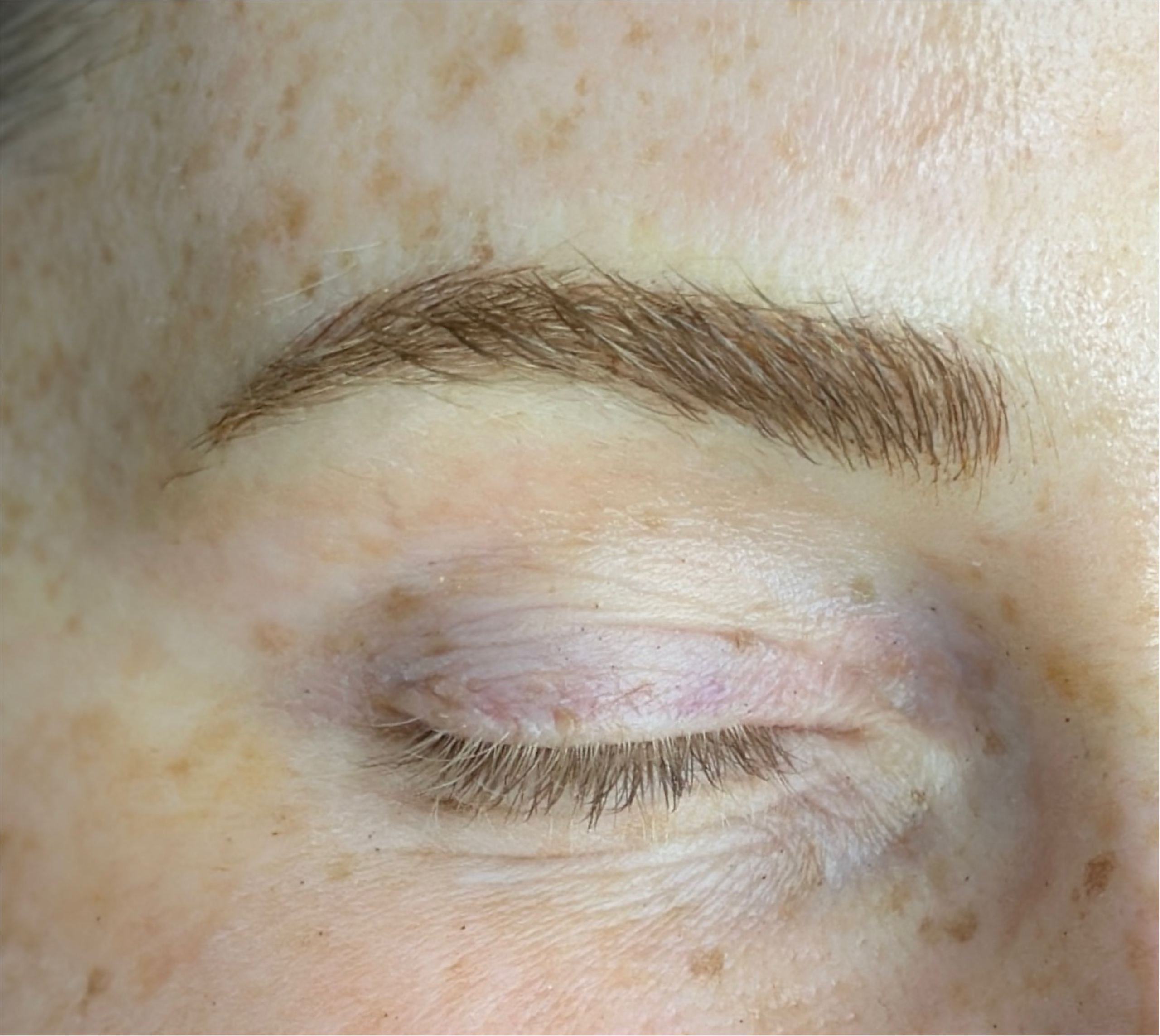 Microblading