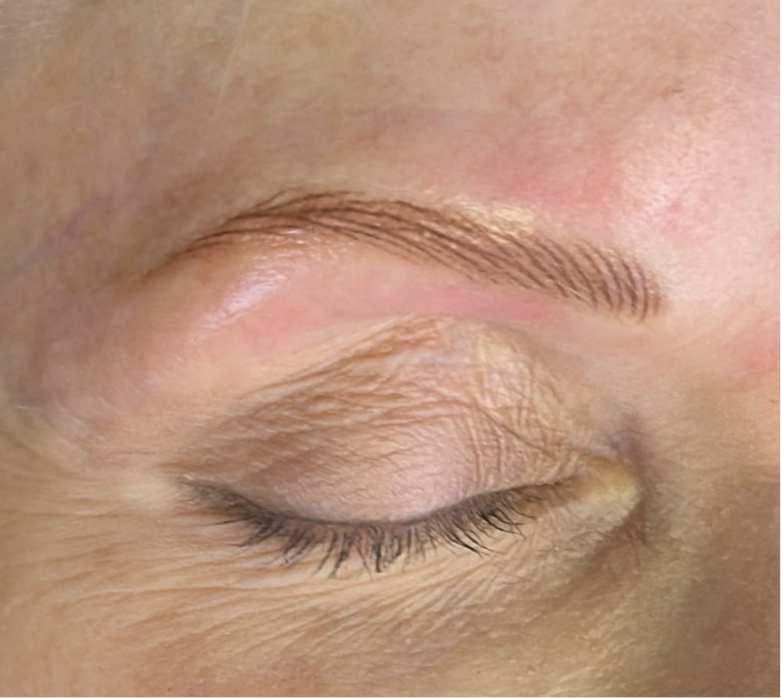 Nano brows
